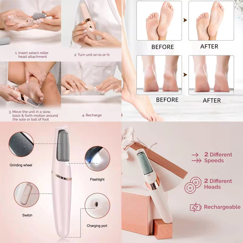 ✨SmoothFeet Pro™ | Electric Callus Remover & Heel Care Tool 🦶💖 - LizzCart